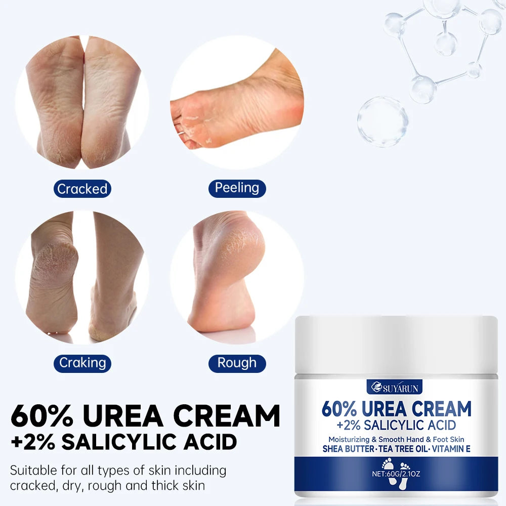 SUYARUN 60% Urea Foot Cream – Cracked Heel, Dry Skin & Callus Care