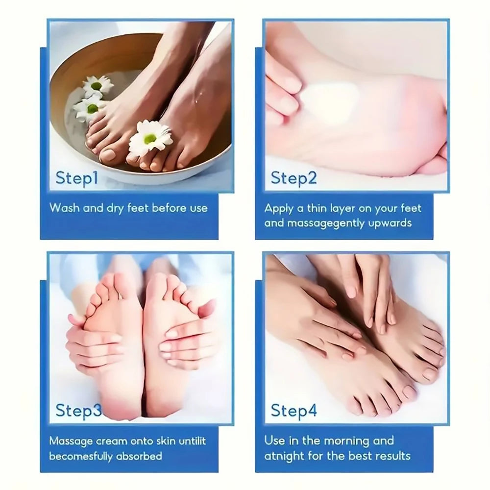 SUYARUN 60% Urea Foot Cream – Cracked Heel, Dry Skin & Callus Care